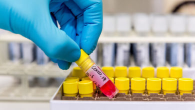 تصویر از استارت آزمایش یک واکسن کرونا از فردا